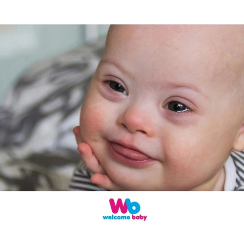 Down Sendromlu Bebek Nasıl Anlaşılır?