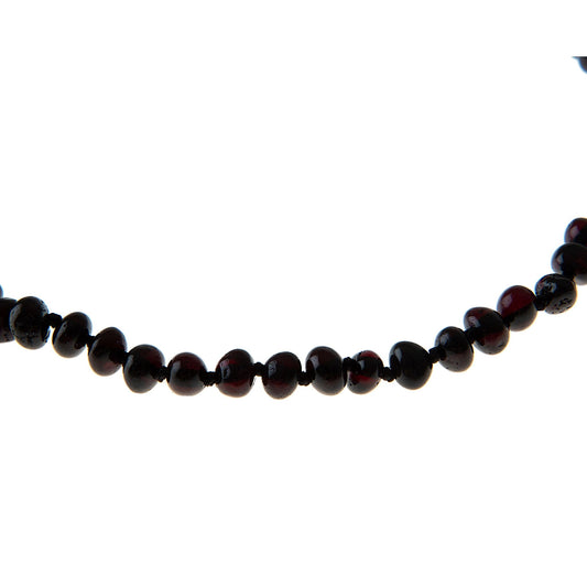 Babyjem Kehribar Bebek Kolyesi̇ Vişne